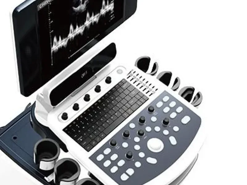 CHISON QBIT 5 Ultrasound