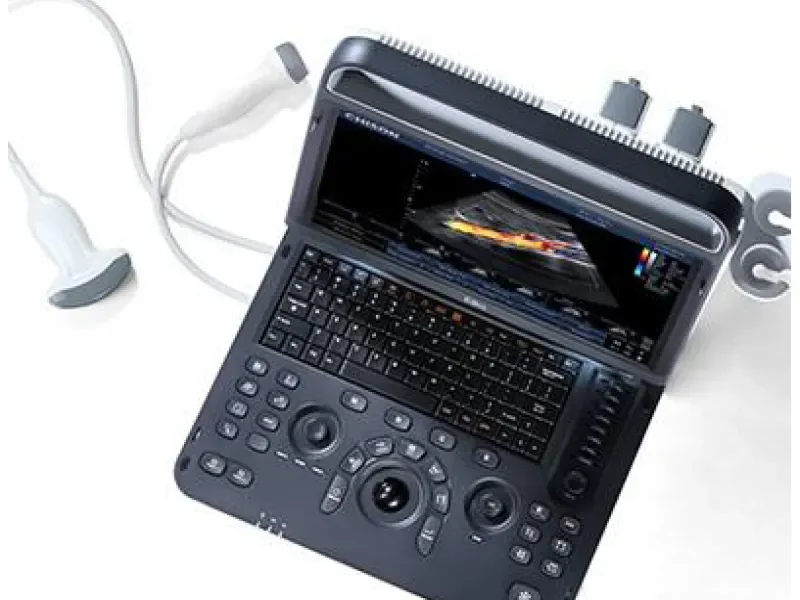 CHISON EBIT 60 High-End Ultrasound