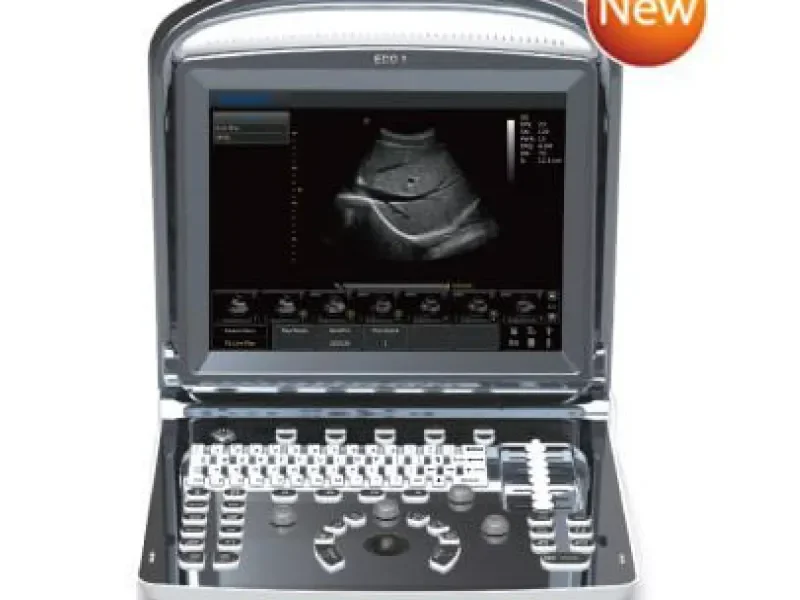 CHISON ECO 1 Entry-Level Ultrasound