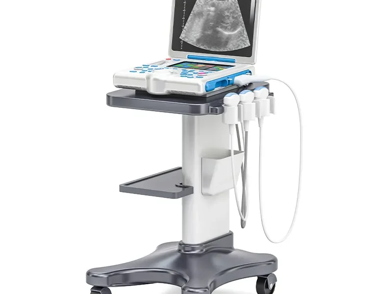 CHISON i3 Portable Ultrasound